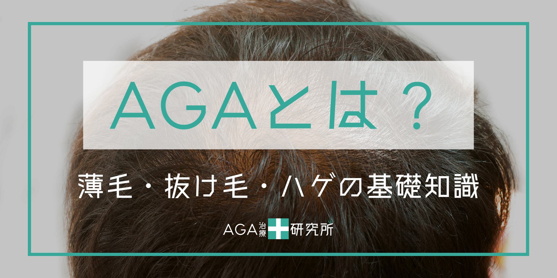 AGA（男性型脱毛症）とは？ | 薄毛・抜け毛・ハゲの原因と初期症状と対策