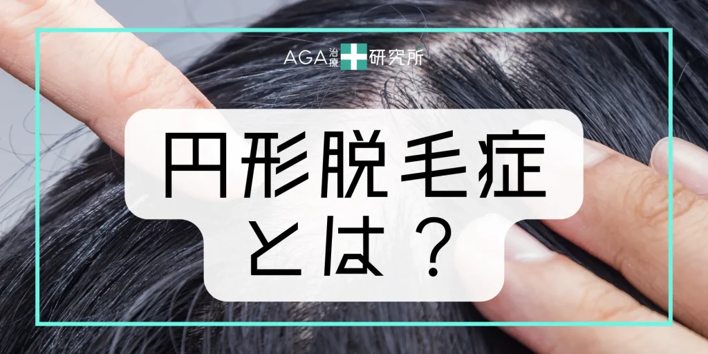 円形脱毛症とは？突然現れる脱毛症の基本情報