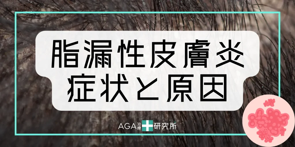 脂漏性皮膚炎の主な症状と原因