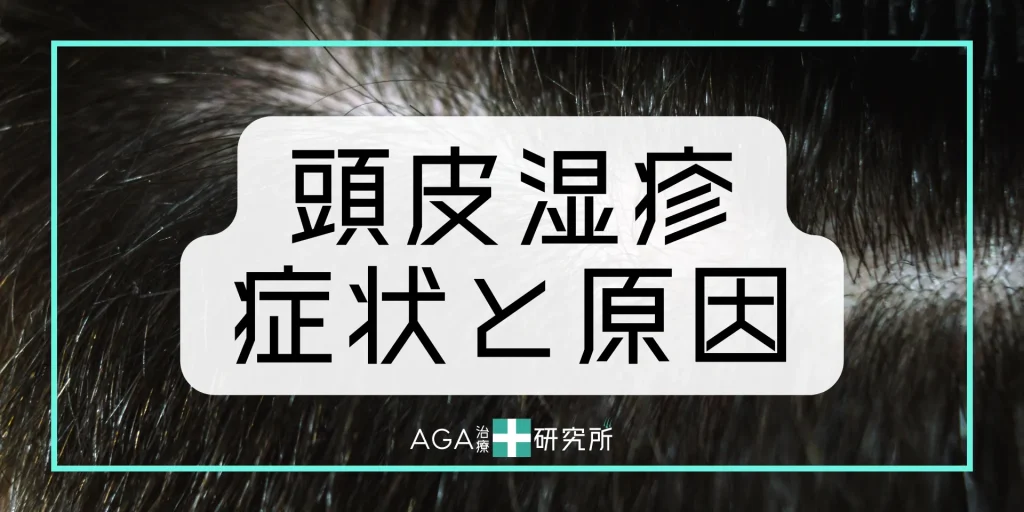 頭皮湿疹とは？その種類と症状